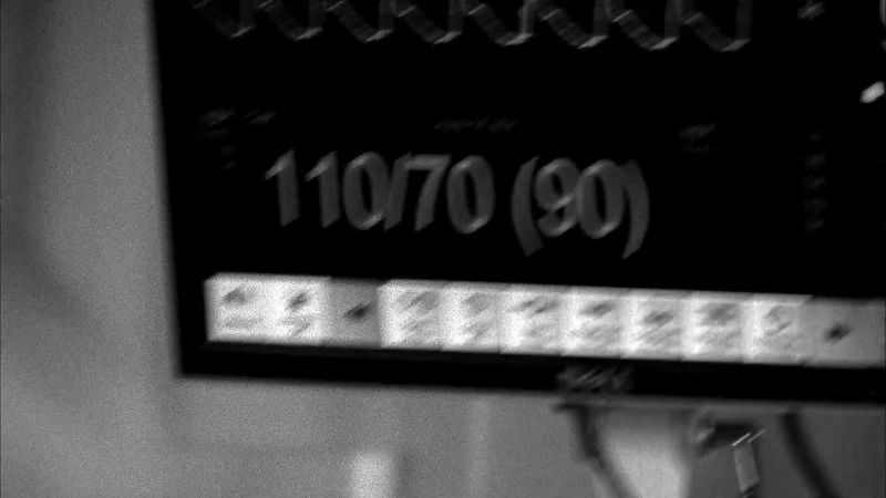 Heart rates 85 beats per minute. BP 110 over 70