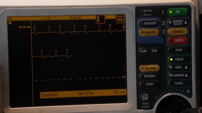 Heart rate's up to 80
