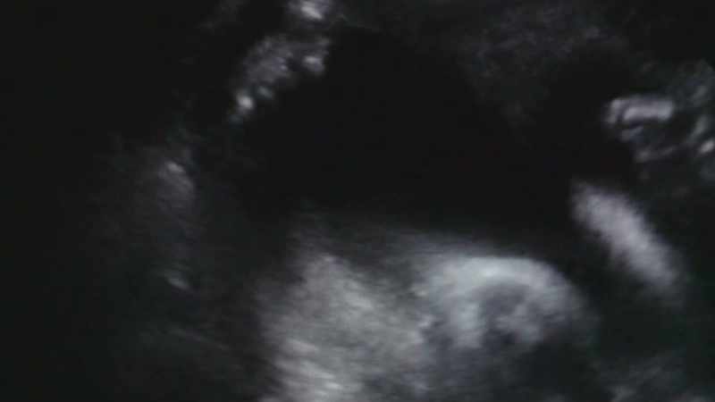 [HEARTBEAT]