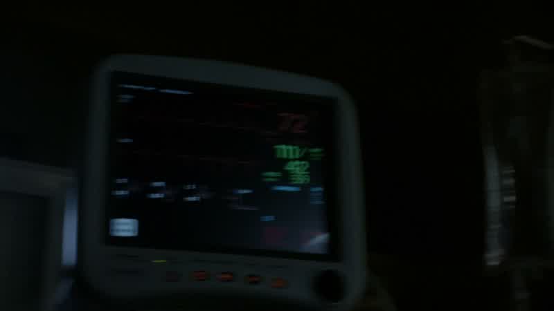 Hemodynamics are stable