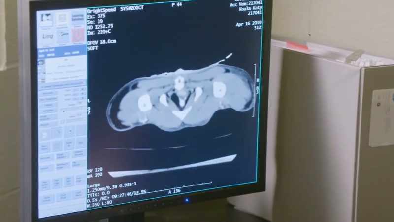 Her guts, well, let's have a look