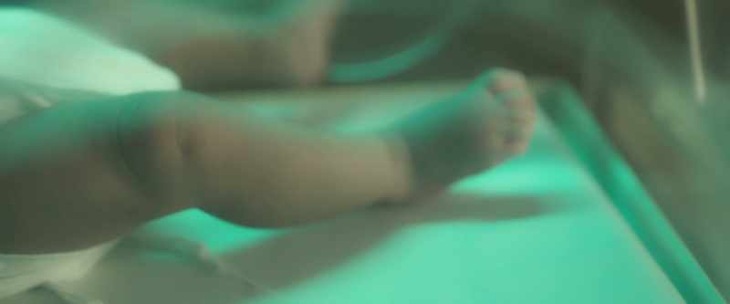 Her optic nerves were pinched during birth