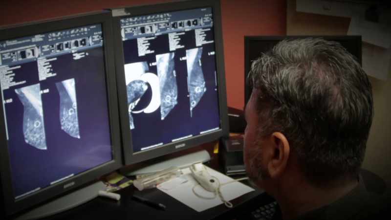 Here in the breast-cancer center