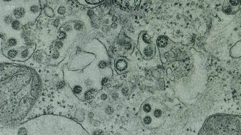 Here, these two are viruses