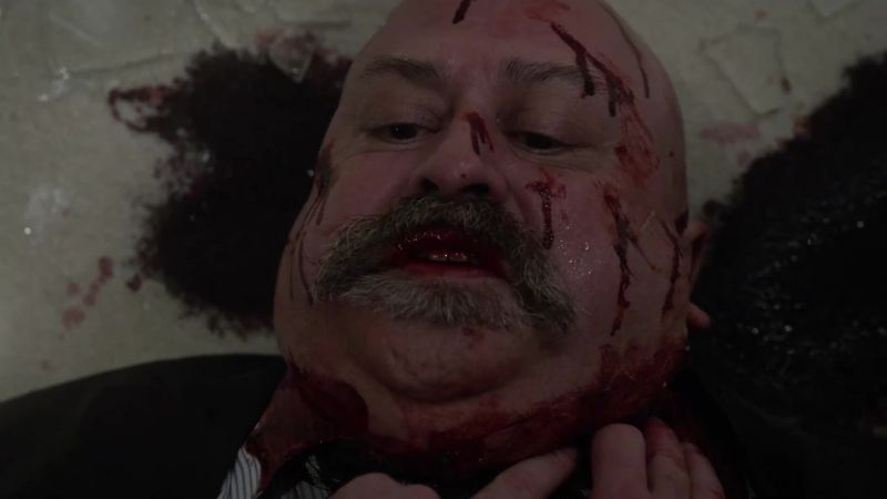 He's bleeding out. Get me a towel now!