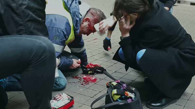 He's bleeding