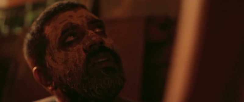 His body was full of scars