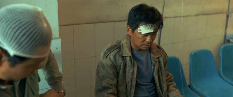 His head injury