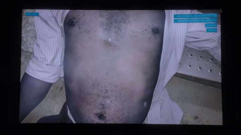 His heart was missing, but there was no incision
