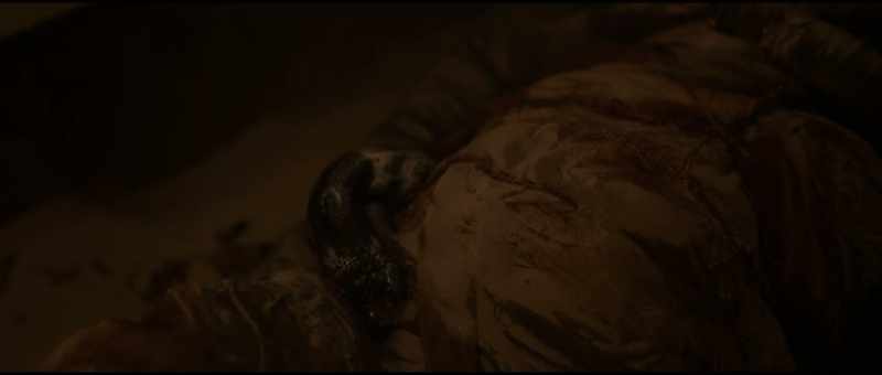 [hissing]