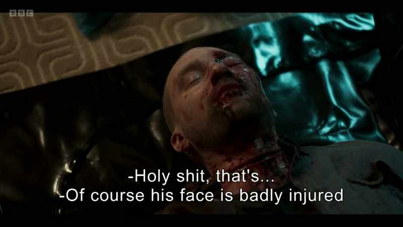 Holy shit, that's... -Of course his face is badly injured