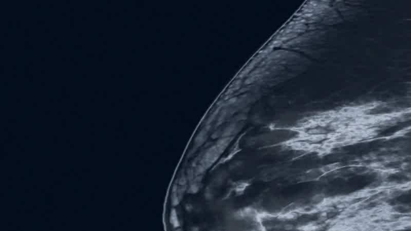 House: No tumor?