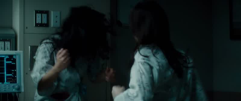 How are those stitches?