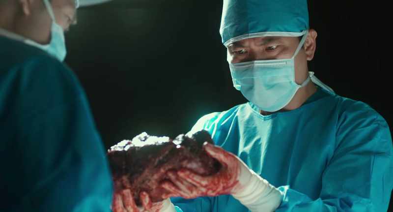 How could a lung harden so badly?
