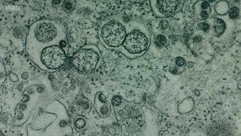 How have electron microscopes allowed us to understand Covid-19?
