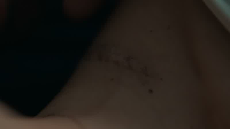 How you got this scar?