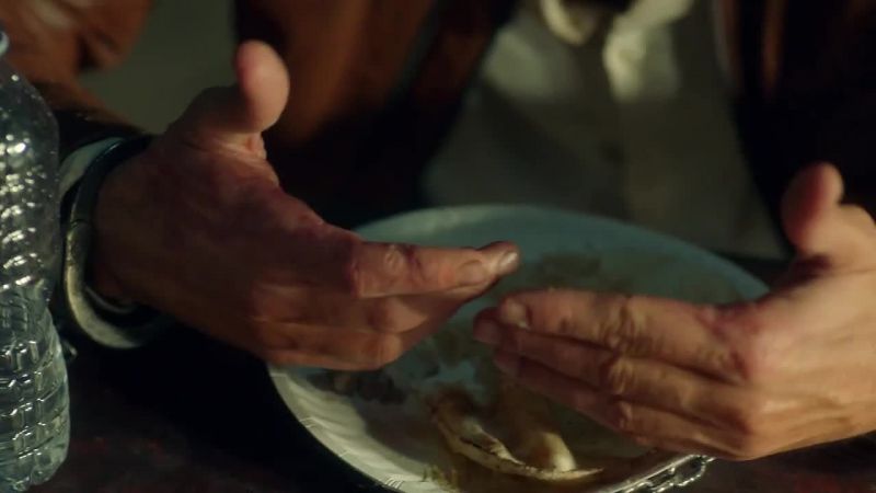 How'd you get those scars on your hands?