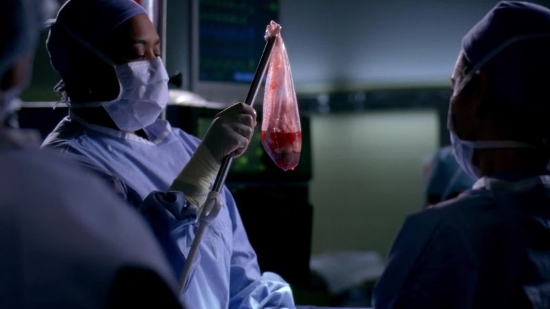 Huh. Now that's what I call a nice-looking kidney