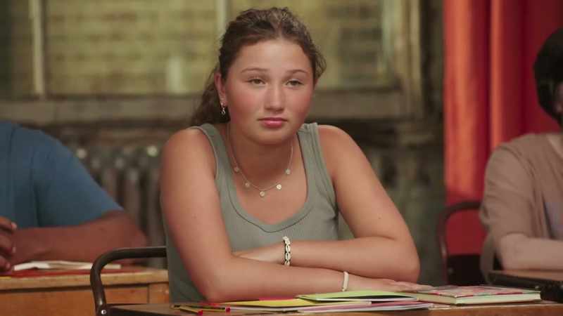 I had a permanent filler inserted into my cheeks back in 2008