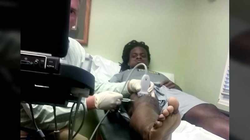 I had an ACL done at FSU