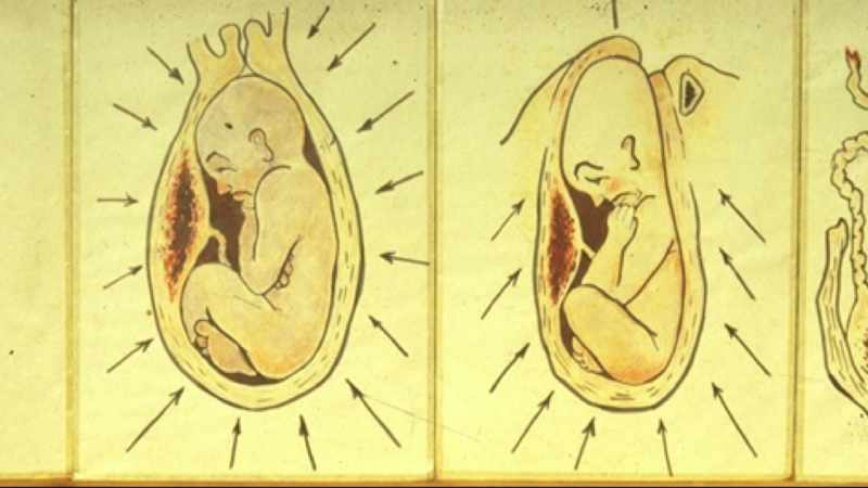 I call them perinatal matrices, basic perinatal matrices