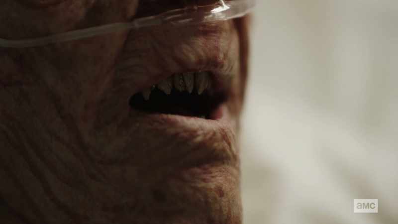 I could give him a nice new smile