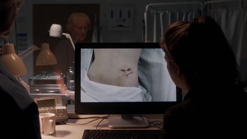 I don't think Jamie's wounds could have been self-inflicted, Tosh