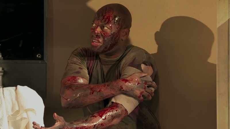 I have some wounds upon me and they smart