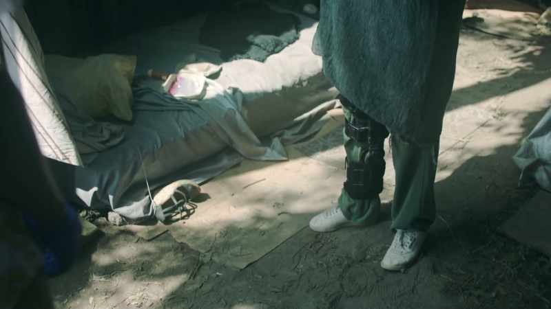 I injured my leg