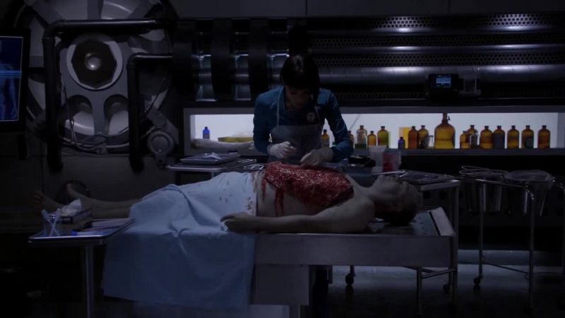 I looked at the guard's X-rays again