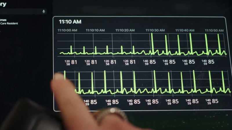 I mean, the heartbeat, it changes
