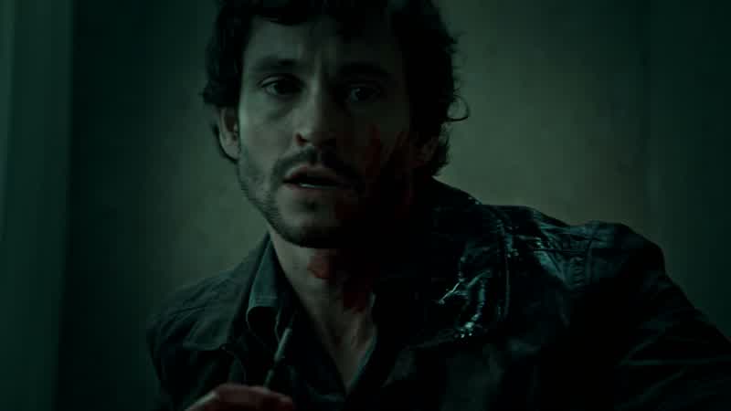 I open his chest wall