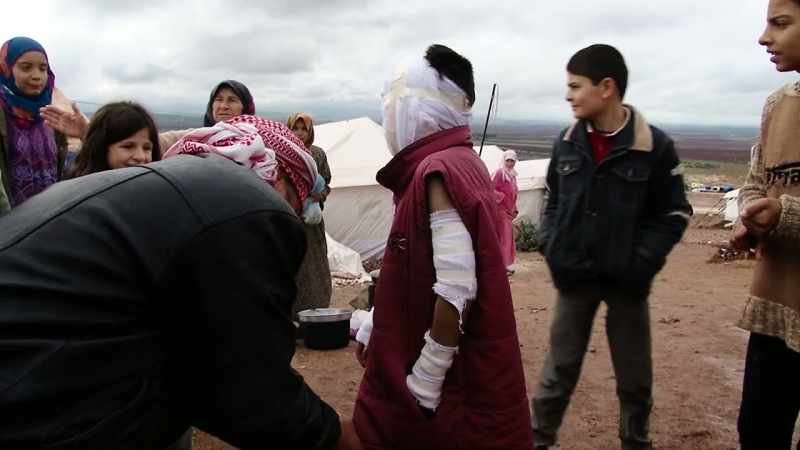 I saw this young boy wrapped in bandages
