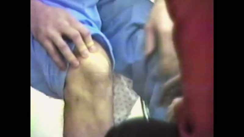 I see marks here