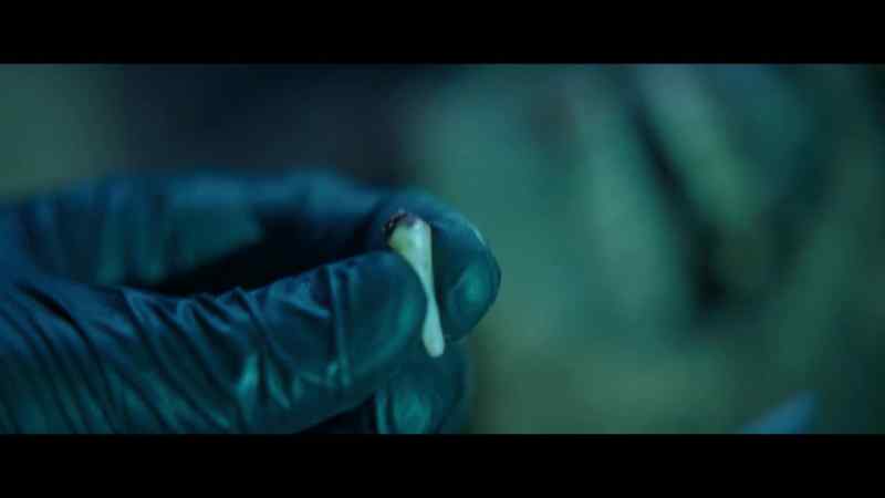 See this? I think this is human skin