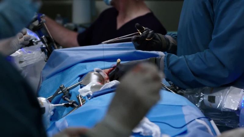 Suture spacing is too wide