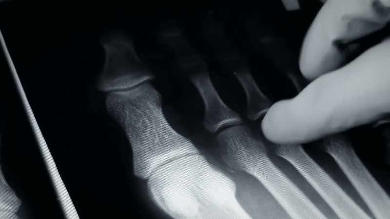 I went to see rheumatologists