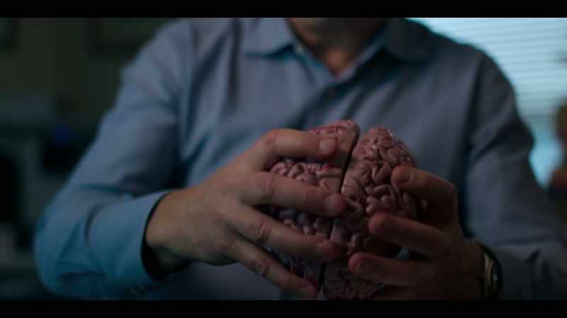 If you look at a model brain