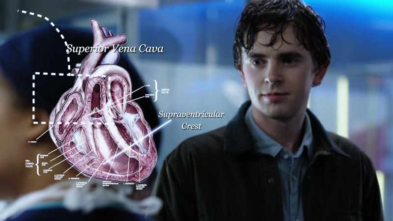 If it punctured the SVC, blood could be leaking