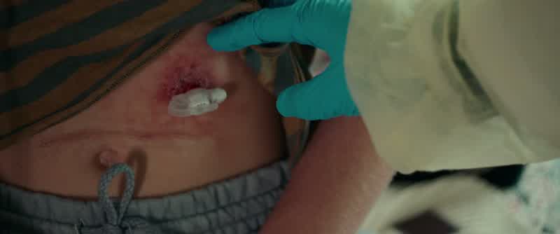 If the infection gets into the bloodstream