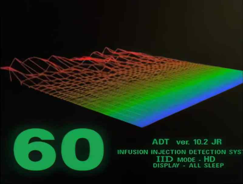 I'm only getting one wave pattern... from the bedroom