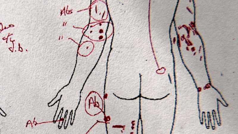 In deposition, even officers involved