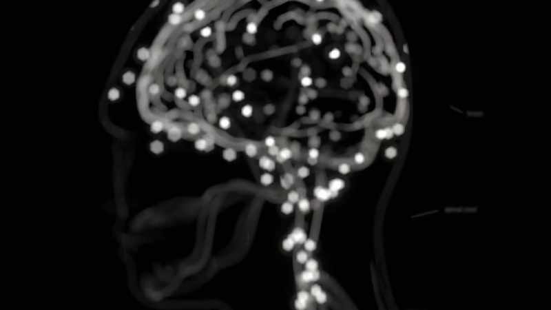In the case of Multiple Sclerosis