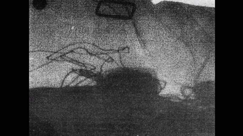 In the X-ray