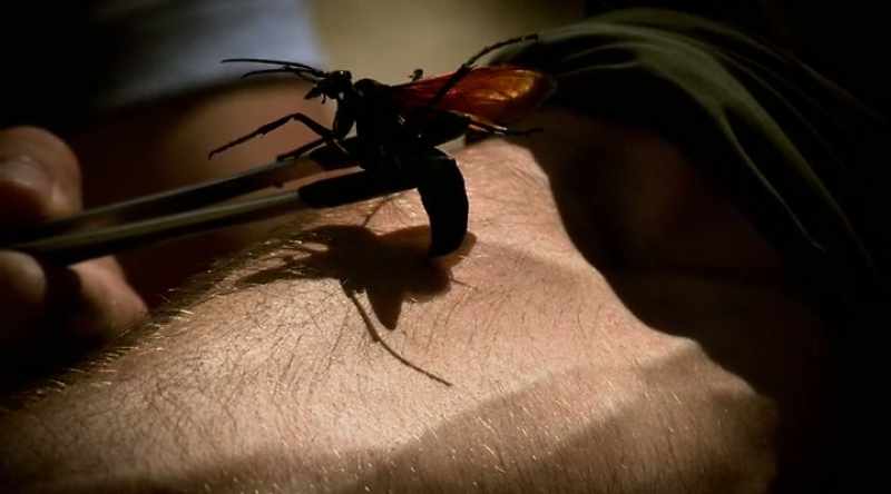 Initially it is like a searing, hot pain