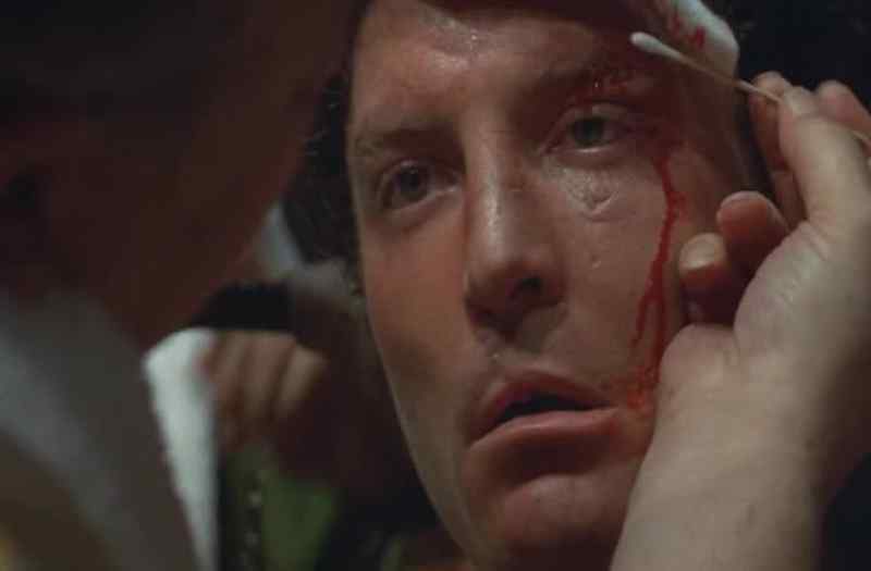 Is that eye all right? - Yeah, he's all right