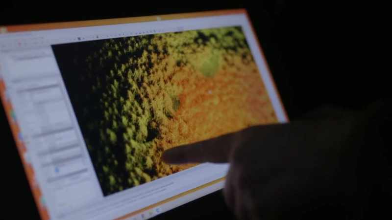 Is that normal to see that many different anomalies on a scan?