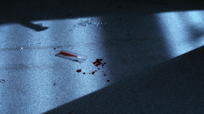 IS THAT BLOOD?