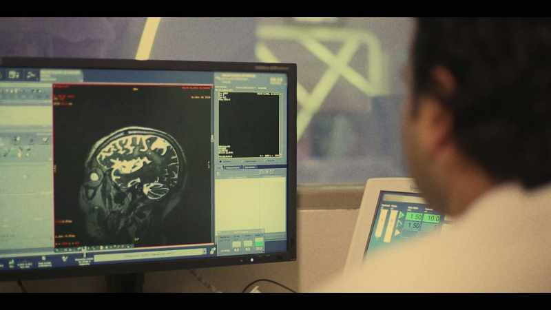 It was a gram-negative bacterial meningoencephalitis