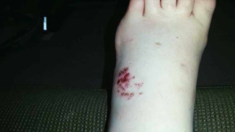 It was infected lots and lots of times